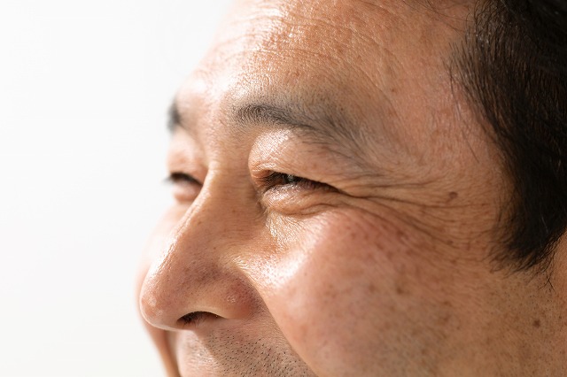 眼瞼下垂とは